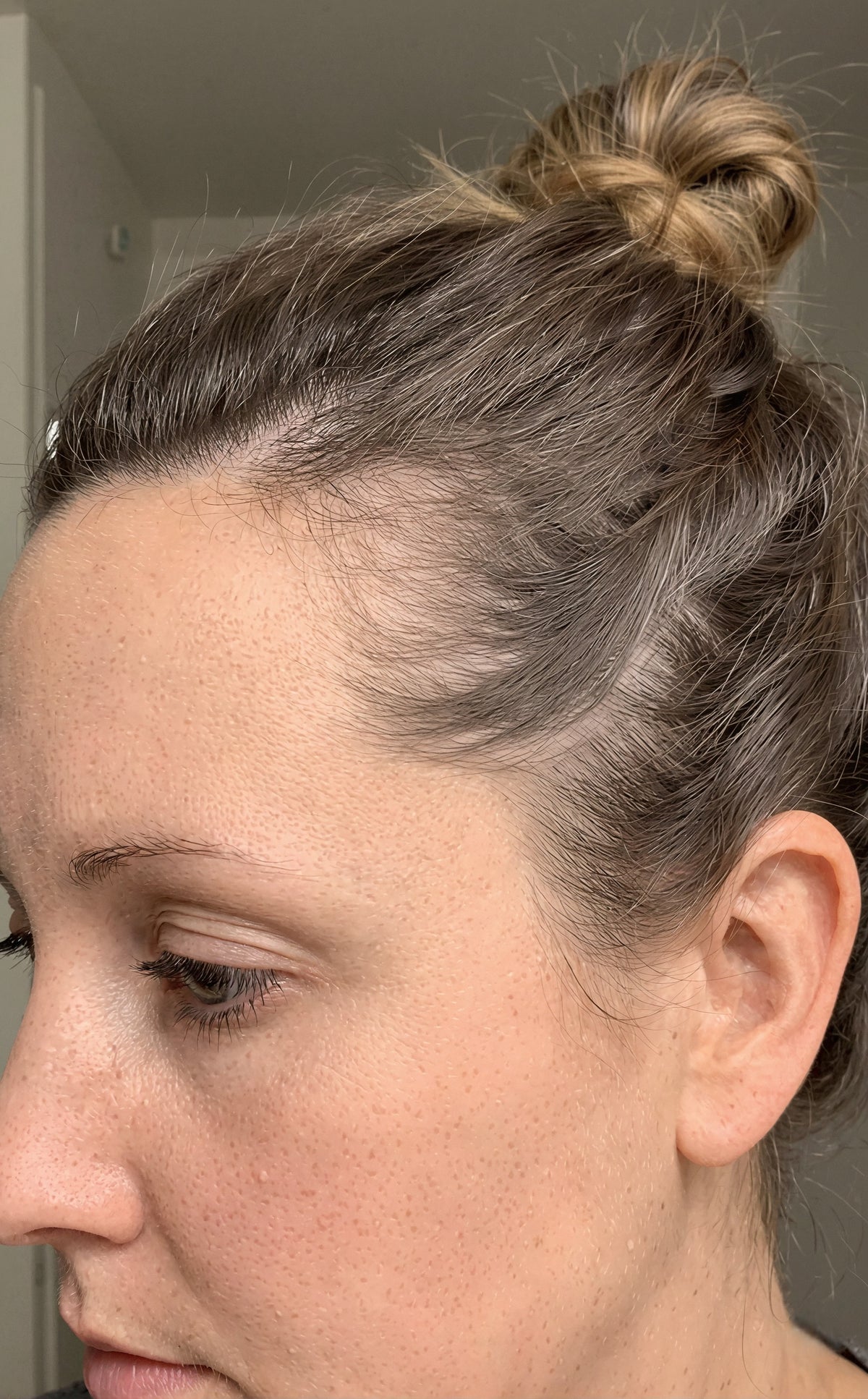 Haar Tag 0